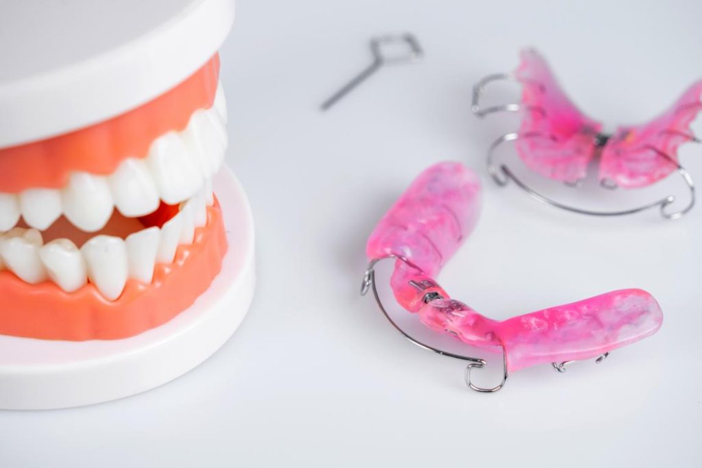 herausnehmbare Zahnspange Zahnspange Kieferorthopäde Dr. Christina Drack